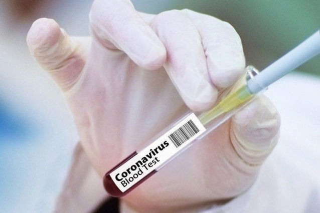 На Житомирщині 3 тижні поспіль фіксується зниження рівня захворюваності на COVID-19