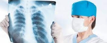 У Житомирській області в минулому році захворіло на активний туберкульоз 405 осіб