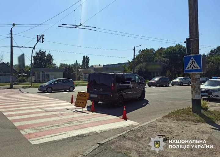 У Житомирі під колеса мікроавтобуса потрапила жінка-пішохід