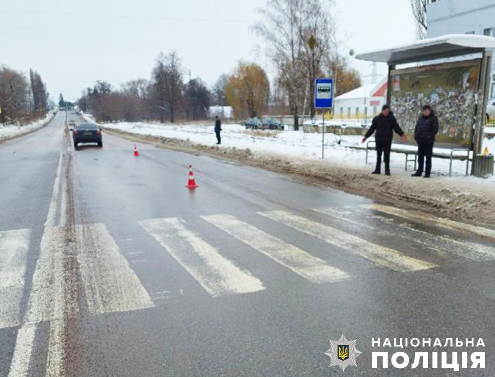У Коростені водій Chevrolet на пішохідному переході збив 8-річного хлопчика, дитина в реанімації