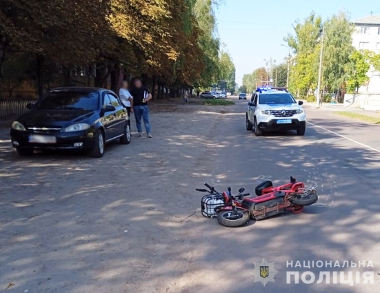 У Коростені в ДТП травмувався водій електровелосипеда, а у Звягелі жінка впала з електроскутера, обоє – в лікарні