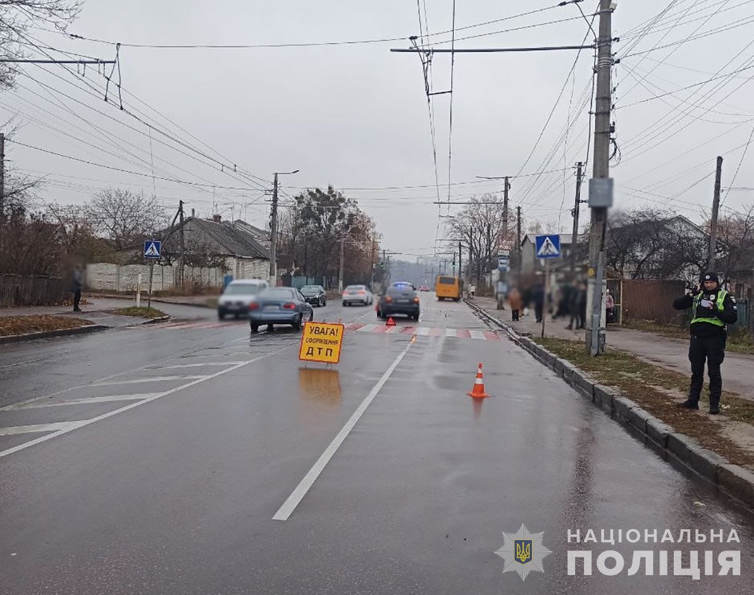 У Житомирі в ДТП травмовано неповнолітню дівчину: 17-річна містянка в лікарні