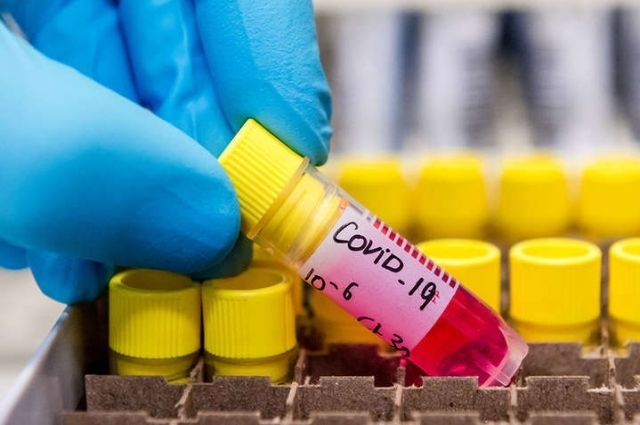 У Житомирській міській лікарні №2 у п'ятьох медичних працівників підтвердили захворювання коронавірусом