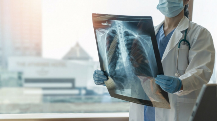 На Житомирщині виявили 607 випадків туберкульозу у 2023 році