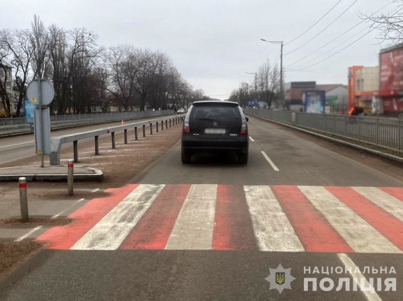 У Коростишеві під колеса автівки  потрапила 39-річна жінка, вона в лікарні