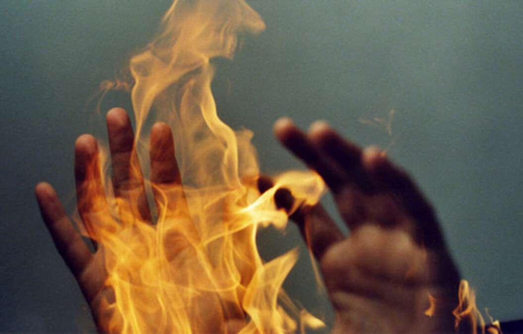 Підпалила куму: у Житомирі 36-річна жінка розпилила на іншу парфумовану воду та піднесла до неї запальничку