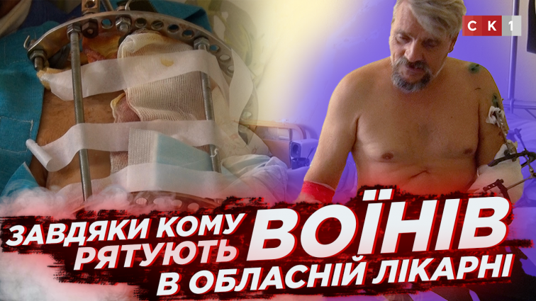 Недостатнє фінансування травматології обласної лікарні: потреби «закривають» волонтери! (ВІДЕО)