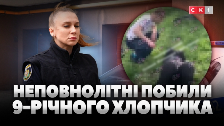 У Житомирі розслідують побиття 9-річного хлопчика