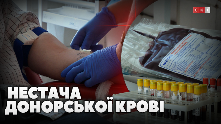 Житомирський обласний центр крові запрошує донорів: наразі є дефіцит усіх груп із негативним резусом (ВІДЕО)