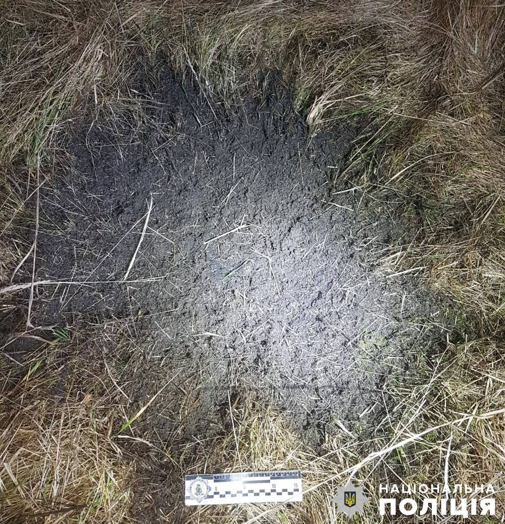 У Попільні 41-річний чоловік підірвав боєприпас на подвір'ї лікарні