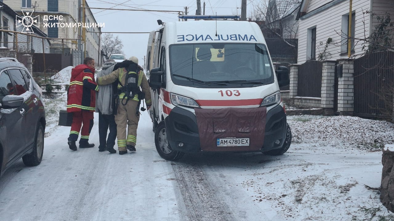 У Коростені під час пожежі в будинку травмувався чоловік