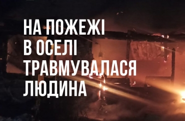 У Звягельському районі під час пожежі у будинку травмувалася людина