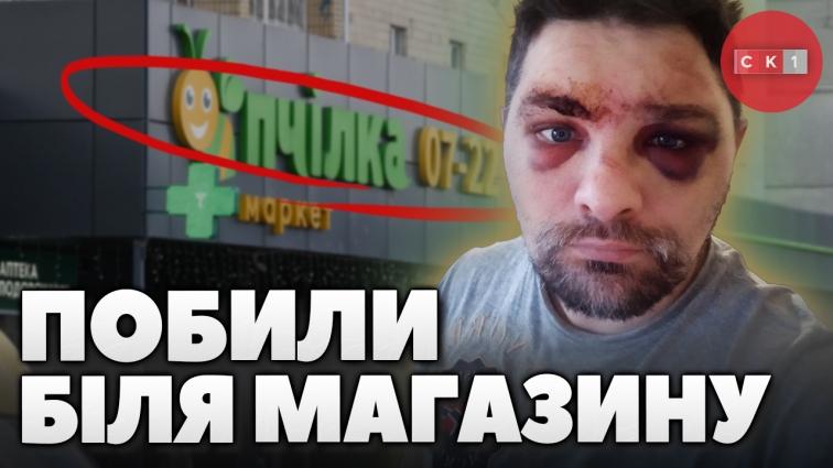 Троє молодиків побили житомирянина: чи покарають винних (ВІДЕО)