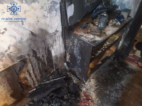 У Звягельському районі під час гасіння пожежі в житловому будинку виявили 34-річну жінку з опіками кінцівок