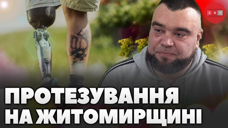 Минулоріч близько 545 військовослужбовців Житомирщини отримали протезне обладнання (ВІДЕО)