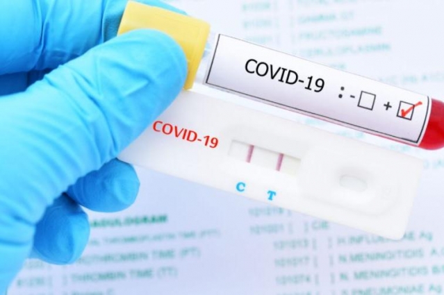 За тиждень на Житомирщині в три рази зріс показник захворюваності на COVID-19