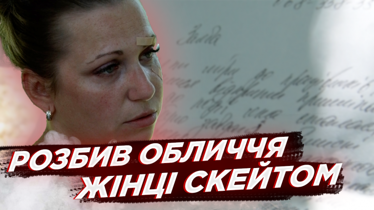 16-річний юнак розбив жінці обличчя скейтом: навмисно чи випадково? (ВІДЕО)
