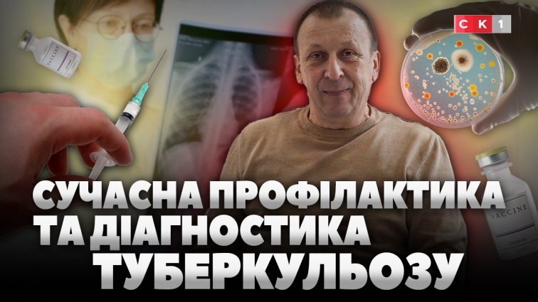 Від проби Манту до сучасних тестів: як сьогодні діагностують туберкульоз (ВІДЕО)