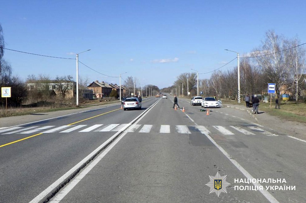 У Гришковецькій громаді під колеса автівки потрапив 11-річний хлопчик, дитина в реанімації