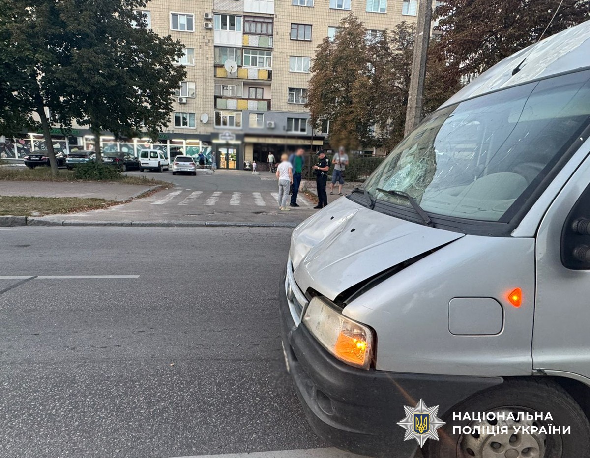 У Житомирі водійка мікроавтобуса наїхала на 80-річного пенсіонера, чоловік в лікарні