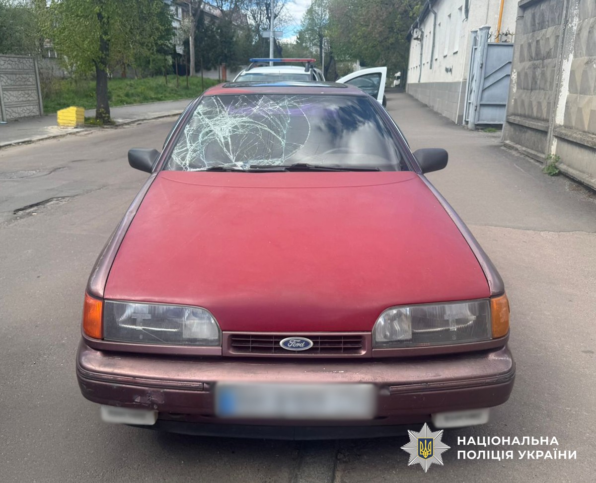 У Житомирі під колеса автомобіля потрапив 39-річний чоловік, він в лікарні